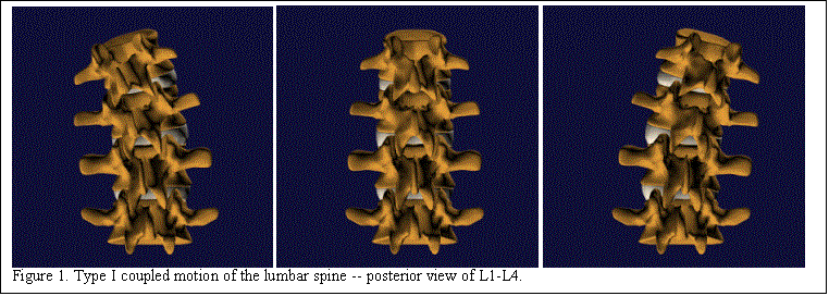 Text Box:      
Figure 1. Type I coupled motion of the lumbar spine -- posterior view of L1-L4.
