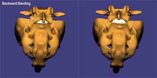 Backbone Slanting Clinical & Functional Significance